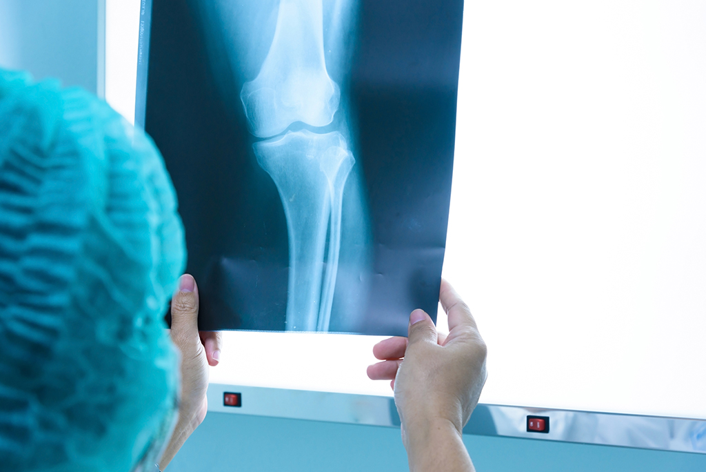 surgeon holding up knee X-ray