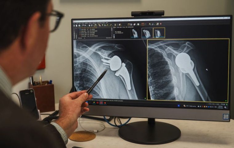 Dr Craig Brownlie Shoulder Surgeon Toowoomba